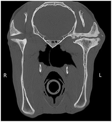 Long-Term Outcome of Horses Undergoing Unilateral Mandibular Condylectomy and Meniscectomy for Temporomandibular Joint Disease